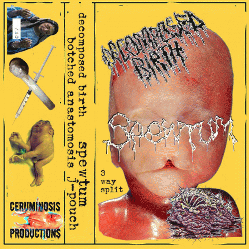 Spewtum : 3 Way Split